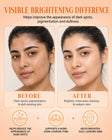 ZIMSHY Vitamin C Face Serum