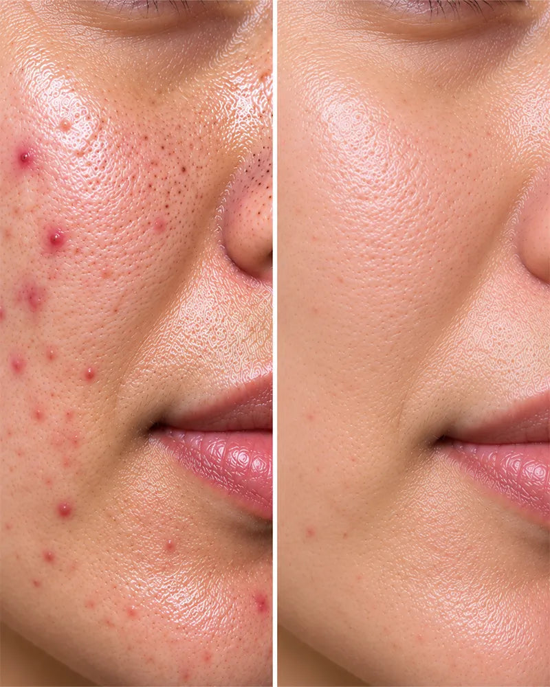 Before & After