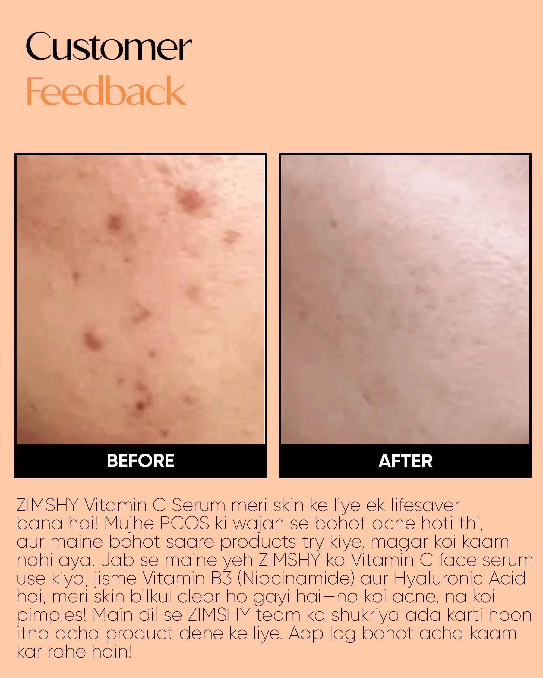 ZIMSHY Rice Extract Face Mask – Oil Control & Pore Minimizing for All Skin Types 120g