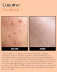 ZIMSHY Vitamin C Face Serum