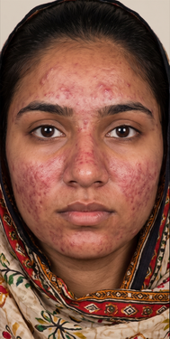 Before — Mahnoor