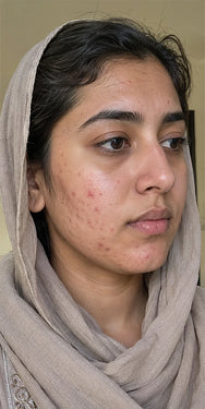 Before — Mahnoor
