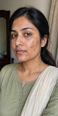 Before — Ayesha